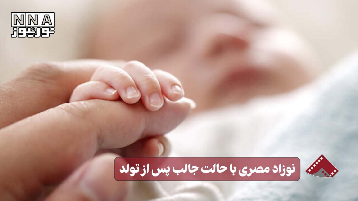 نورنما |نوزاد مصری با حالت جالب پس از تولد