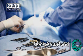 نورویدئو | زیبایی فوری به شرط چاقو!
