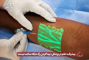 نورنما | پیشرفت در پزشکی ؛ پیدا کردن رگ دیگه سخت نیست +فیلم