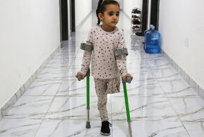 انجام 4 هزار و 50 عمل قطع عضو در غزه