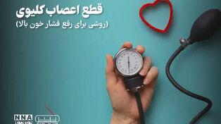 پادکست | قطع اعصاب کلیوی (روشی برای رفع فشار خون بالا )