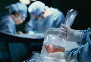 What Explains Iran Outperforming Canada and UK in Living Organ Donation?