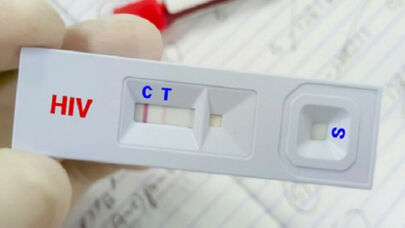 کاهش سهم «اعتیاد» در انتقال HIV؛ تغییر الگوی انتقال بیماری در ایران