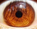 Iran among 5 countries in eye stem cell transplantation